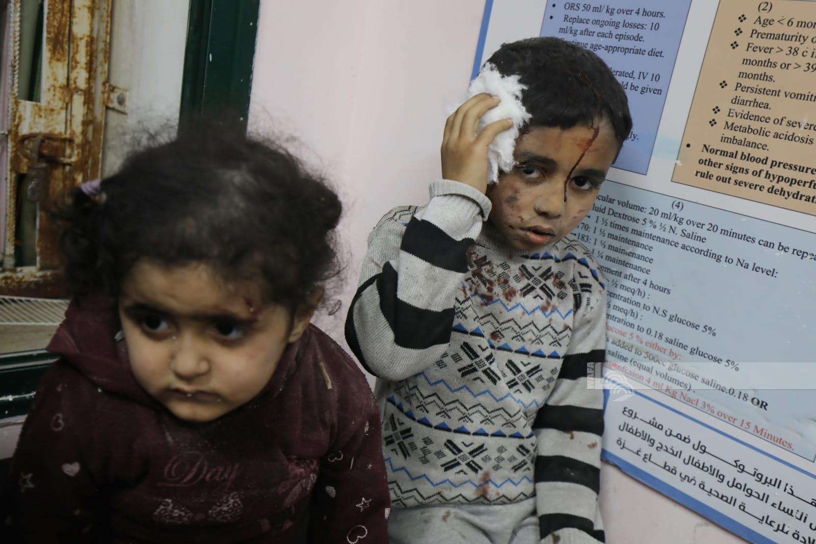 طفلان يتلقيان العلاج في مستشفى شهداء الأقصى في دير البلح جراء إصابتهما في غارة إسرائيلية (تصوير: وفا)